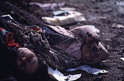Erməni silahlı qüvvələrinin hücumu zamanı öldürülən qadın və uşaq meyiti
