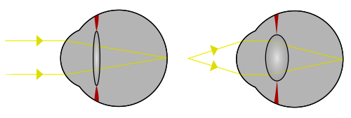 Gözdə akkomodasiya